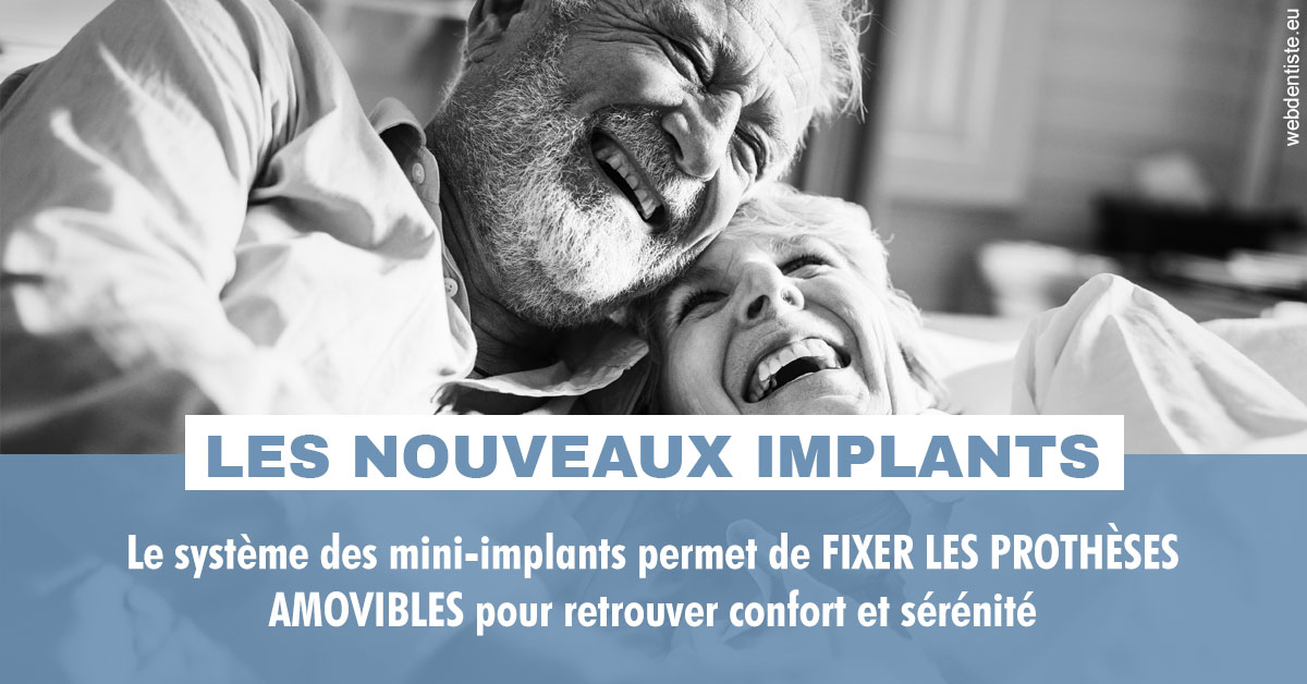 https://www.dr-weiss-sarfati.fr/Les nouveaux implants 2