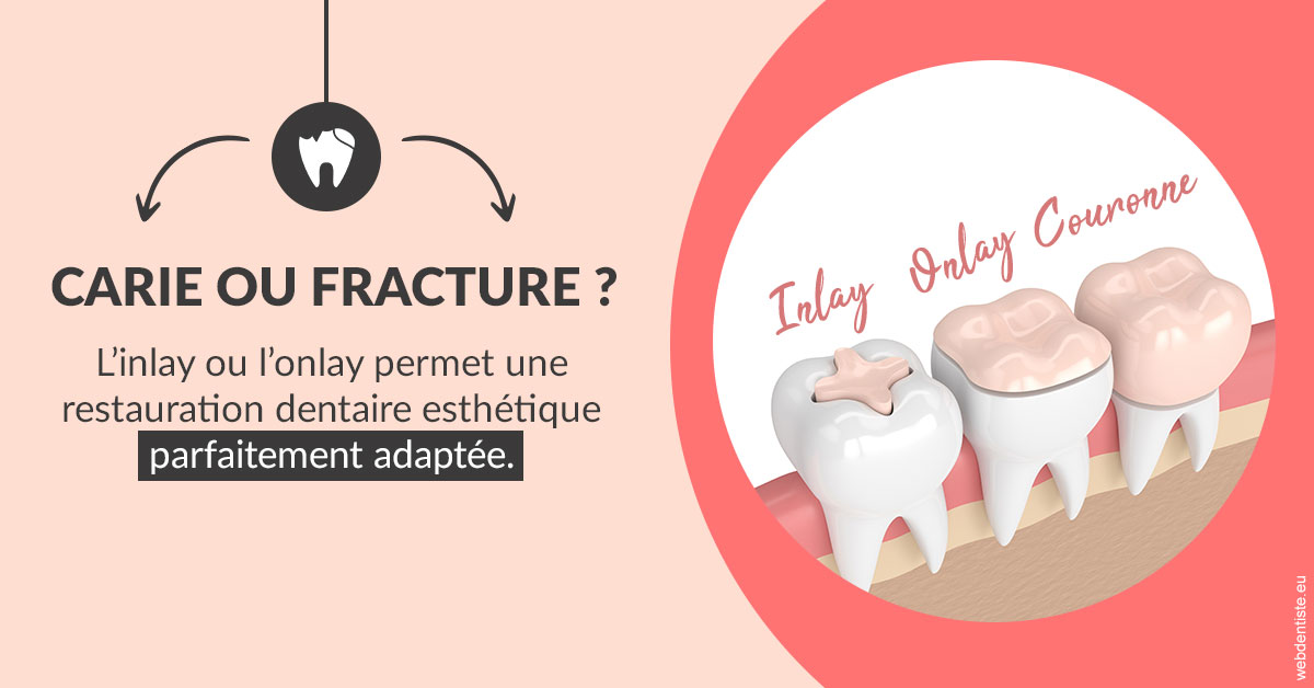 https://www.dr-weiss-sarfati.fr/T2 2023 - Carie ou fracture 2