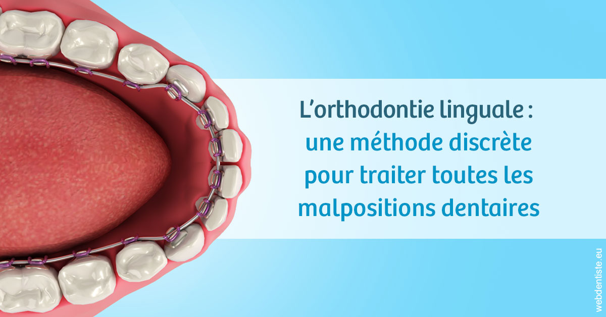 https://www.dr-weiss-sarfati.fr/L'orthodontie linguale 1