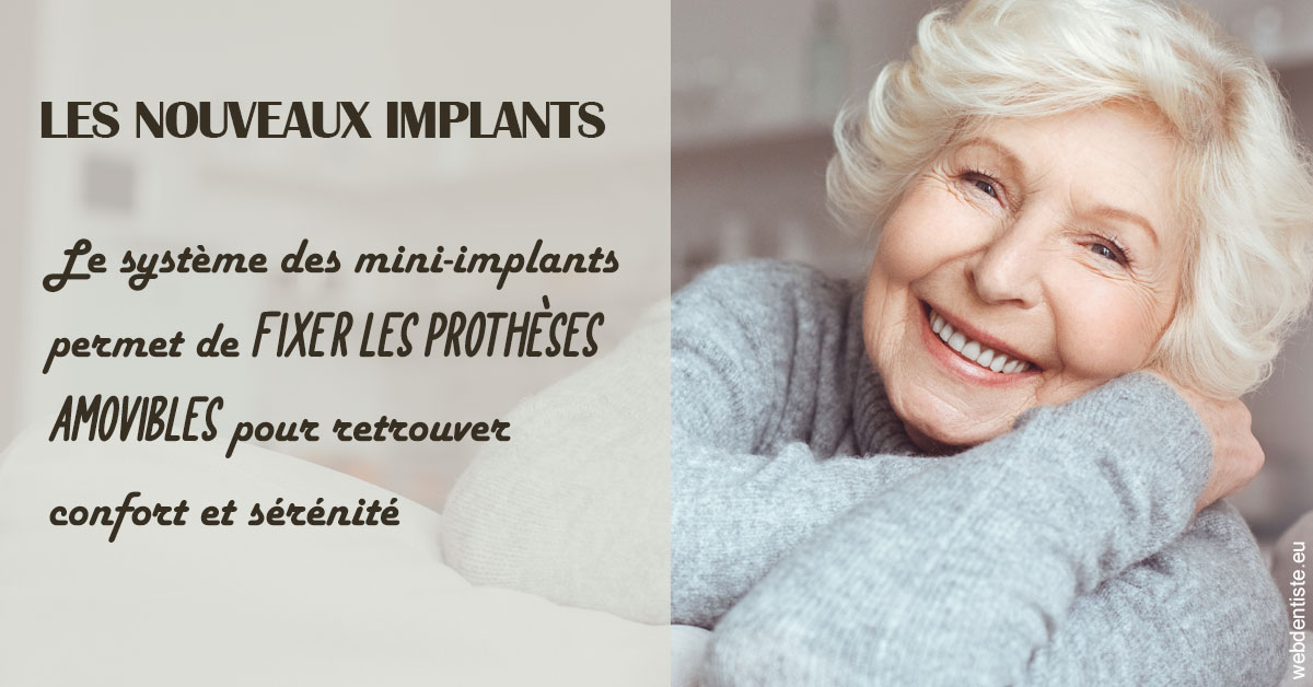 https://www.dr-weiss-sarfati.fr/Les nouveaux implants 1