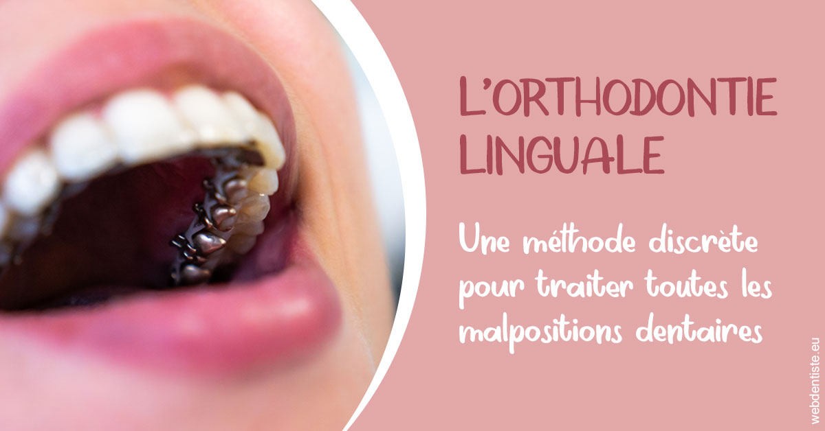 https://www.dr-weiss-sarfati.fr/L'orthodontie linguale 2