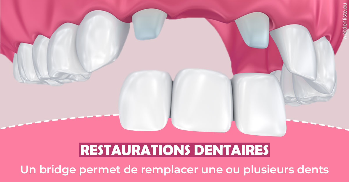 https://www.dr-weiss-sarfati.fr/Bridge remplacer dents 2