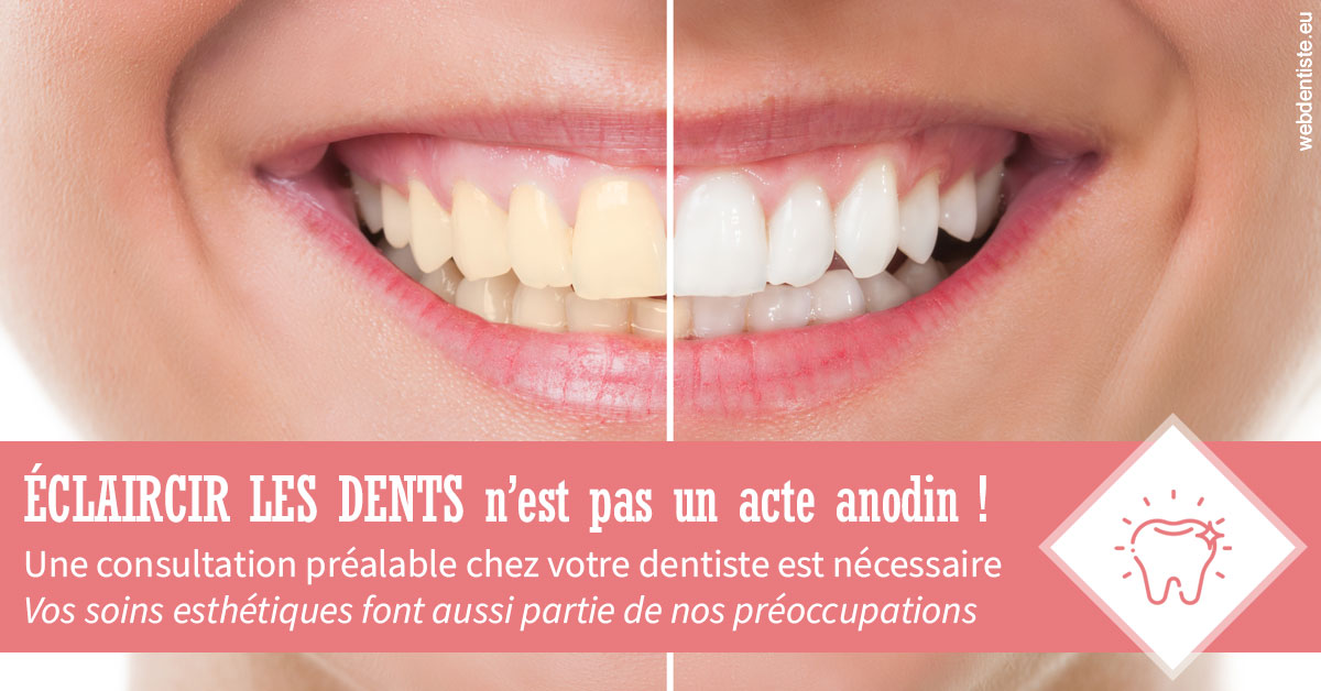 https://www.dr-weiss-sarfati.fr/Eclaircir les dents 1