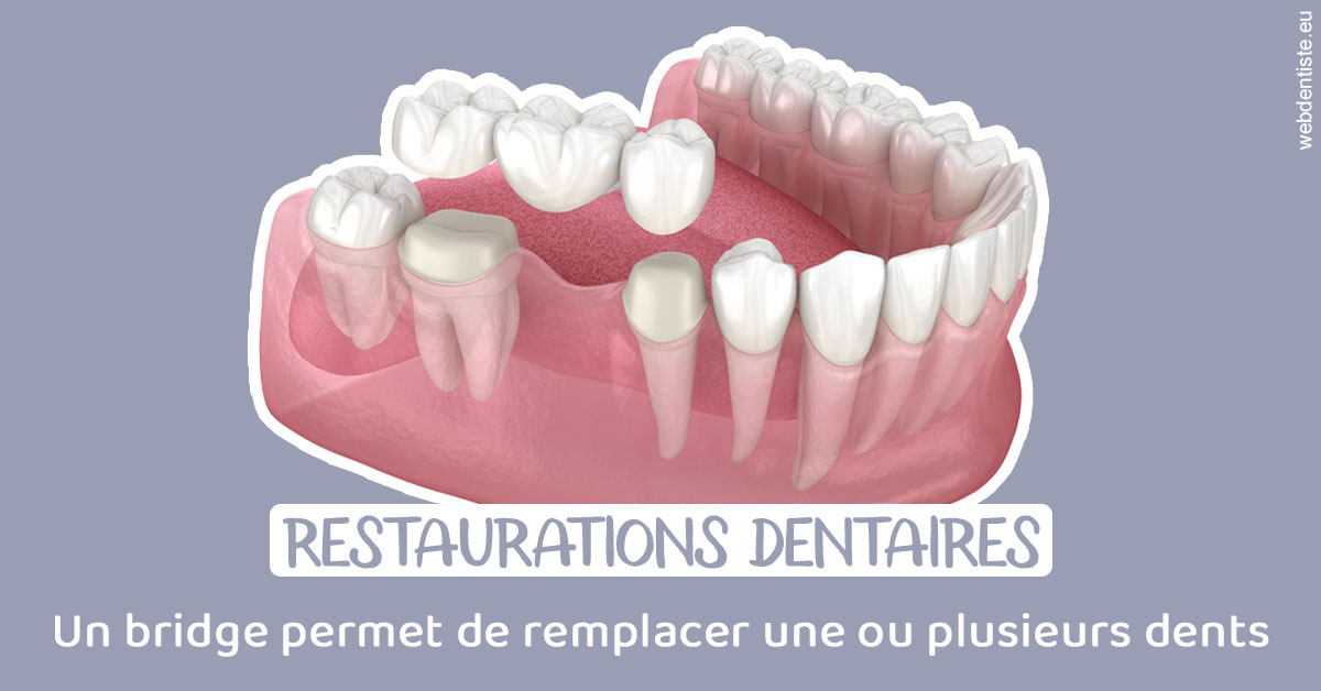 https://www.dr-weiss-sarfati.fr/Bridge remplacer dents 1