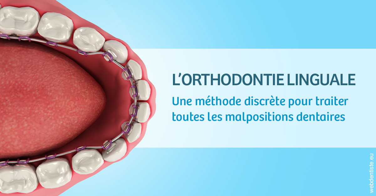 https://www.dr-weiss-sarfati.fr/L'orthodontie linguale 1