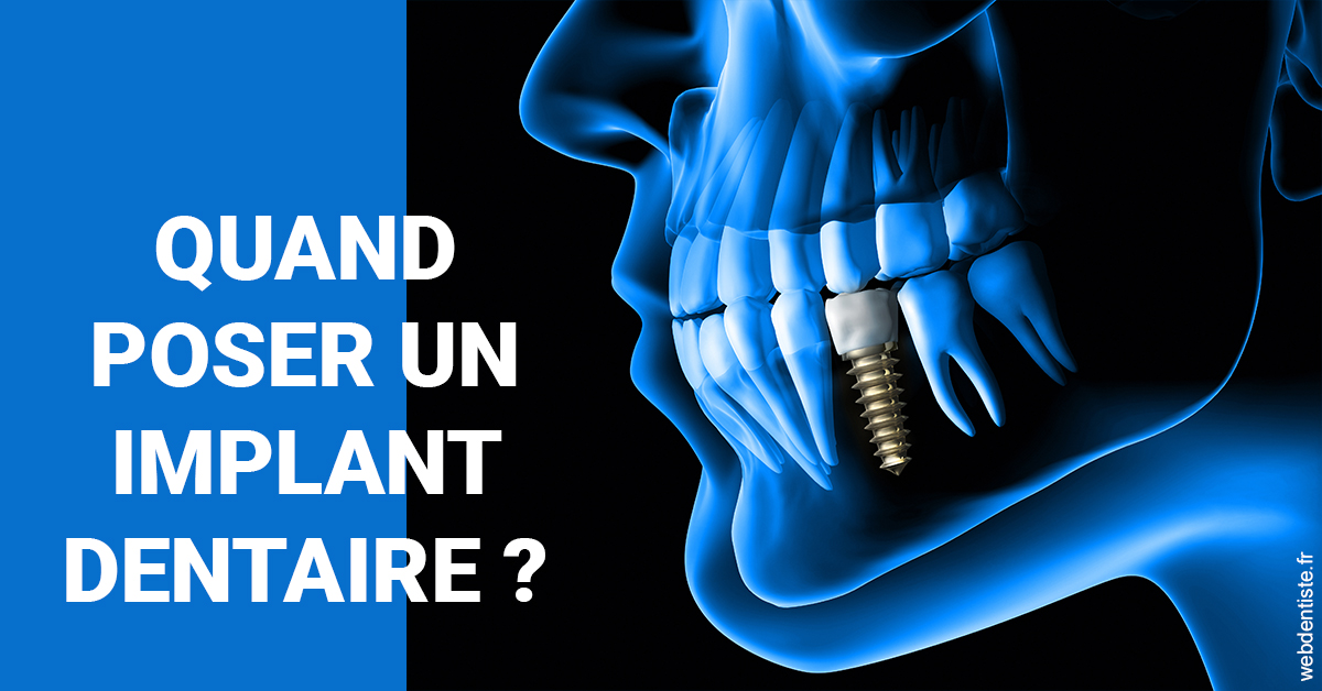 https://www.dr-weiss-sarfati.fr/Les implants 1