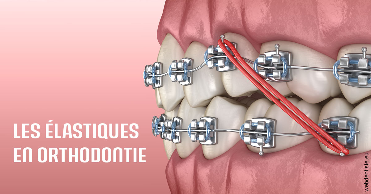 https://www.dr-weiss-sarfati.fr/Elastiques orthodontie 2